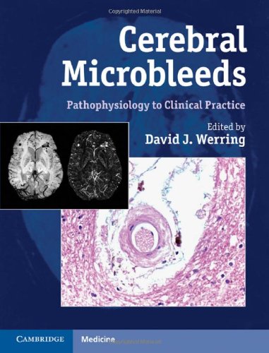 Cerebral Microbleeds: Pathophysiology to Clinical Practice 2011