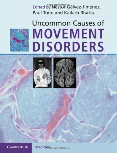 Uncommon Causes of Movement Disorders 2011