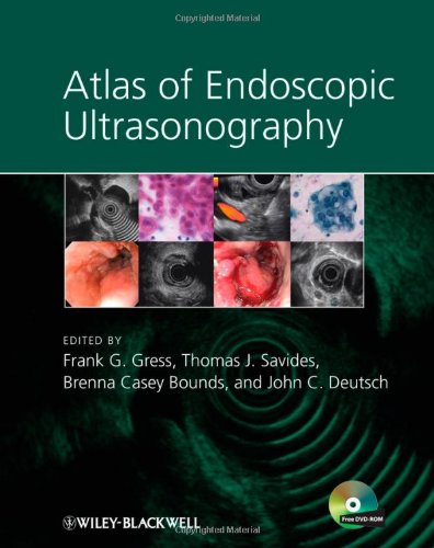 Atlas of Endoscopic Ultrasonography 2011