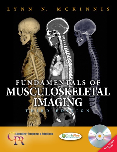 Fundamentals of Musculoskeletal Imaging 2010