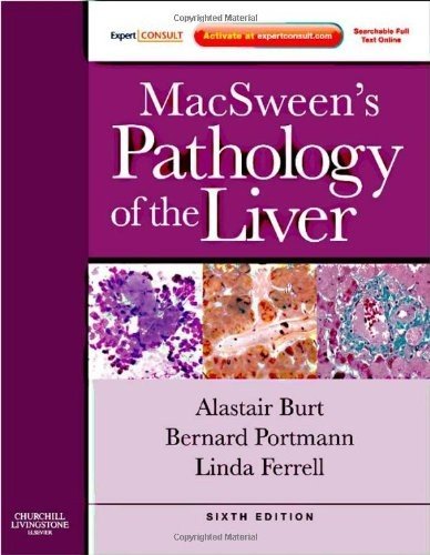 MacSween's Pathology of the Liver 2011