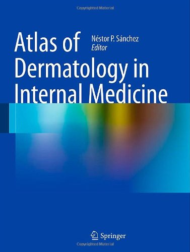 Atlas of Dermatology in Internal Medicine 2011