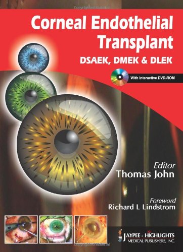 Corneal Endothelial Transplant DSEAK, DMEK and DLEK 2010
