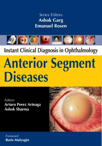 Anterior Segment Diseases 2010