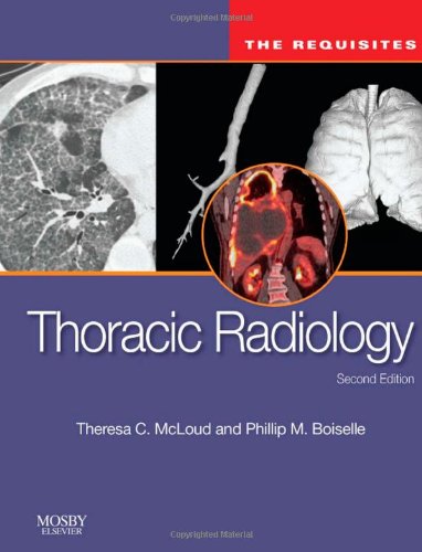 Thoracic Radiology: The Requisites 2010
