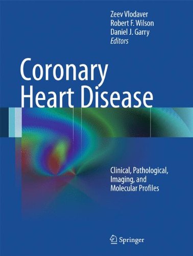 Coronary Heart Disease: Clinical, Pathological, Imaging, and Molecular Profiles 2012