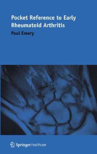 Pocket Reference to Early Rheumatoid Arthritis 2011