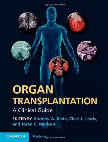 Organ Transplantation: A Clinical Guide 2011