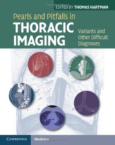 Pearls and Pitfalls in Thoracic Imaging: Variants and Other Difficult Diagnoses 2011
