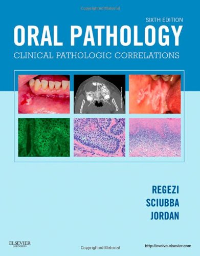Oral Pathology: Clinical Pathologic Correlations 2012