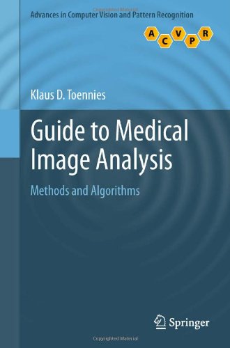 Guide to Medical Image Analysis: Methods and Algorithms 2012