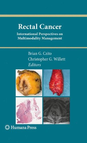 Rectal Cancer: International Perspectives on Multimodality Management 2010