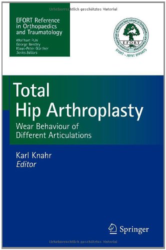 Total Hip Arthroplasty: Wear Behaviour of Different Articulations 2012
