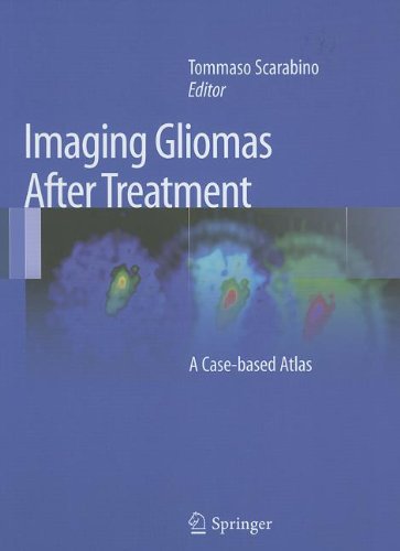 Imaging Gliomas After Treatment: A Case-based Atlas 2011
