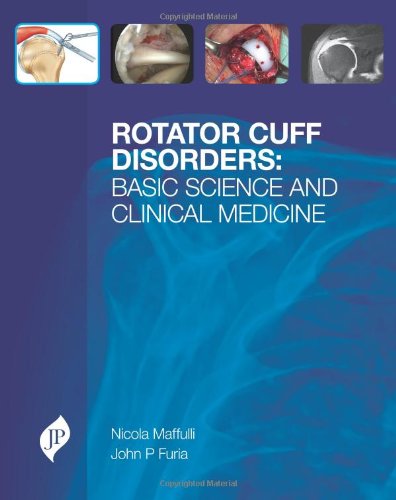 Rotator Cuff Disorders: Basic Science and Clinical Medicine 2012