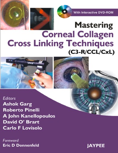 Mastering Corneal Collagen Cross-linking Techniques (C3-R/CCL/CxL) 2008