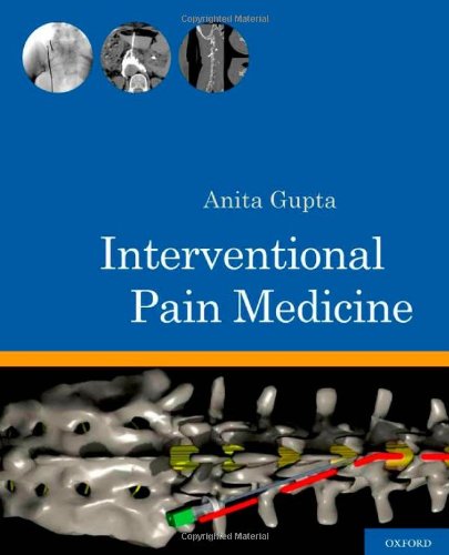 Interventional Pain Medicine 2012