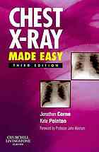Chest X-Ray Made Easy E-Book 2009