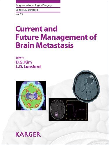 Current and Future Management of Brain Metastasis 2012