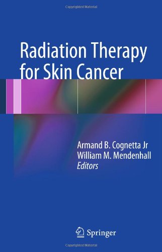 رادیوتراپی برای سرطان پوست