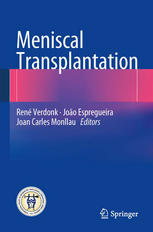 Meniscal Transplantation 2013