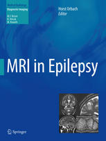 MRI in Epilepsy 2013