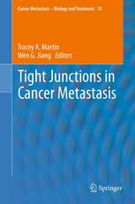 Tight Junctions in Cancer Metastasis 2013