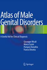 Atlas of Male Genital Disorders: A Useful Aid for Clinical Diagnosis 2012