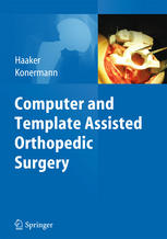 Computer and Template Assisted Orthopedic Surgery 2013