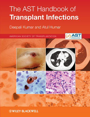 The AST Handbook of Transplant Infections 2011