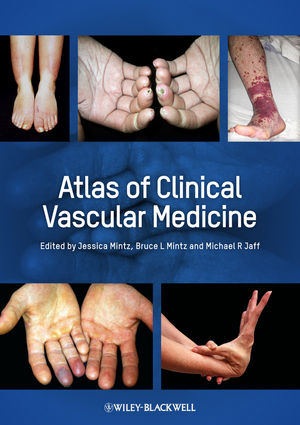 Atlas of Clinical Vascular Medicine 2013