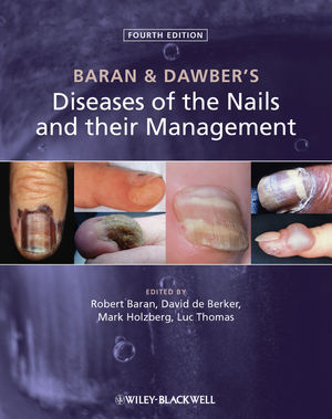 Baran and Dawber's Diseases of the Nails and their Management 2012