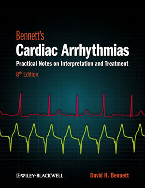 Bennett's Cardiac Arrhythmias: Practical Notes on Interpretation and Treatment 2013