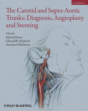The Carotid and Supra-Aortic Trunks: Diagnosis, Angioplasty and Stenting 2011
