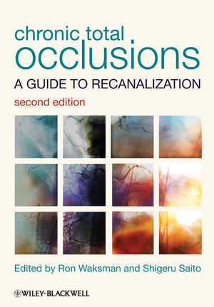 Chronic Total Occlusions: A Guide to Recanalization 2013