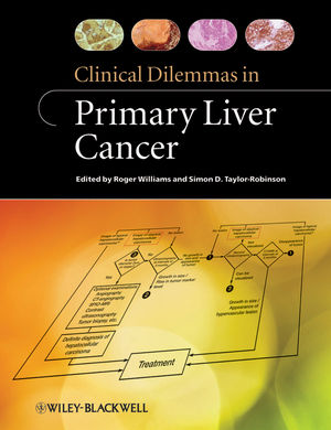 Clinical Dilemmas in Primary Liver Cancer 2011