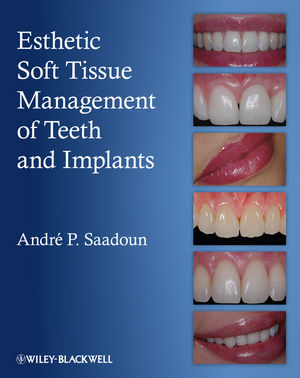 Esthetic Soft Tissue Management of Teeth and Implants 2012
