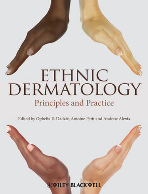 Ethnic Dermatology: Principles and Practice 2013