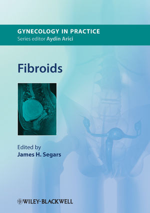 Fibroids 2013