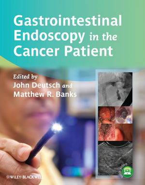Gastrointestinal Endoscopy in the Cancer Patient 2013