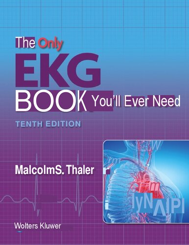 تنها کتاب EKG که به آن نیاز دارید