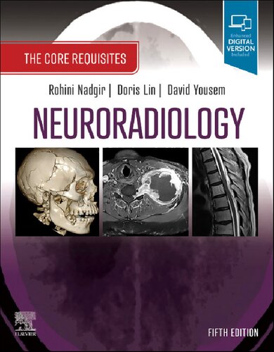 Neuroradiology: موارد اصلی