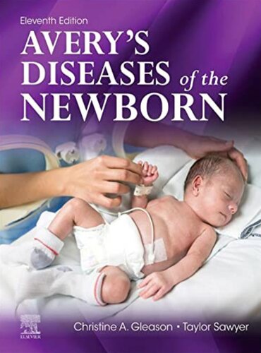 بیماری های اوری از نوزاد