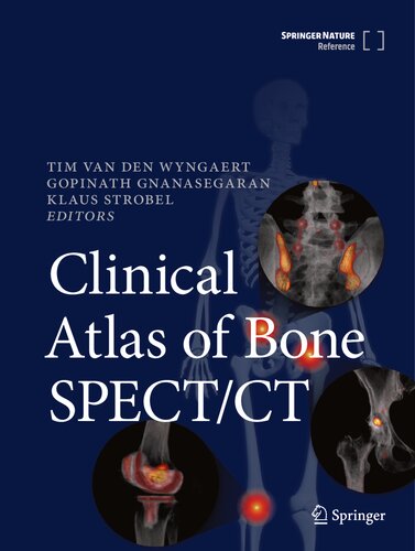 اطلس بالینی SPECT/CT استخوان