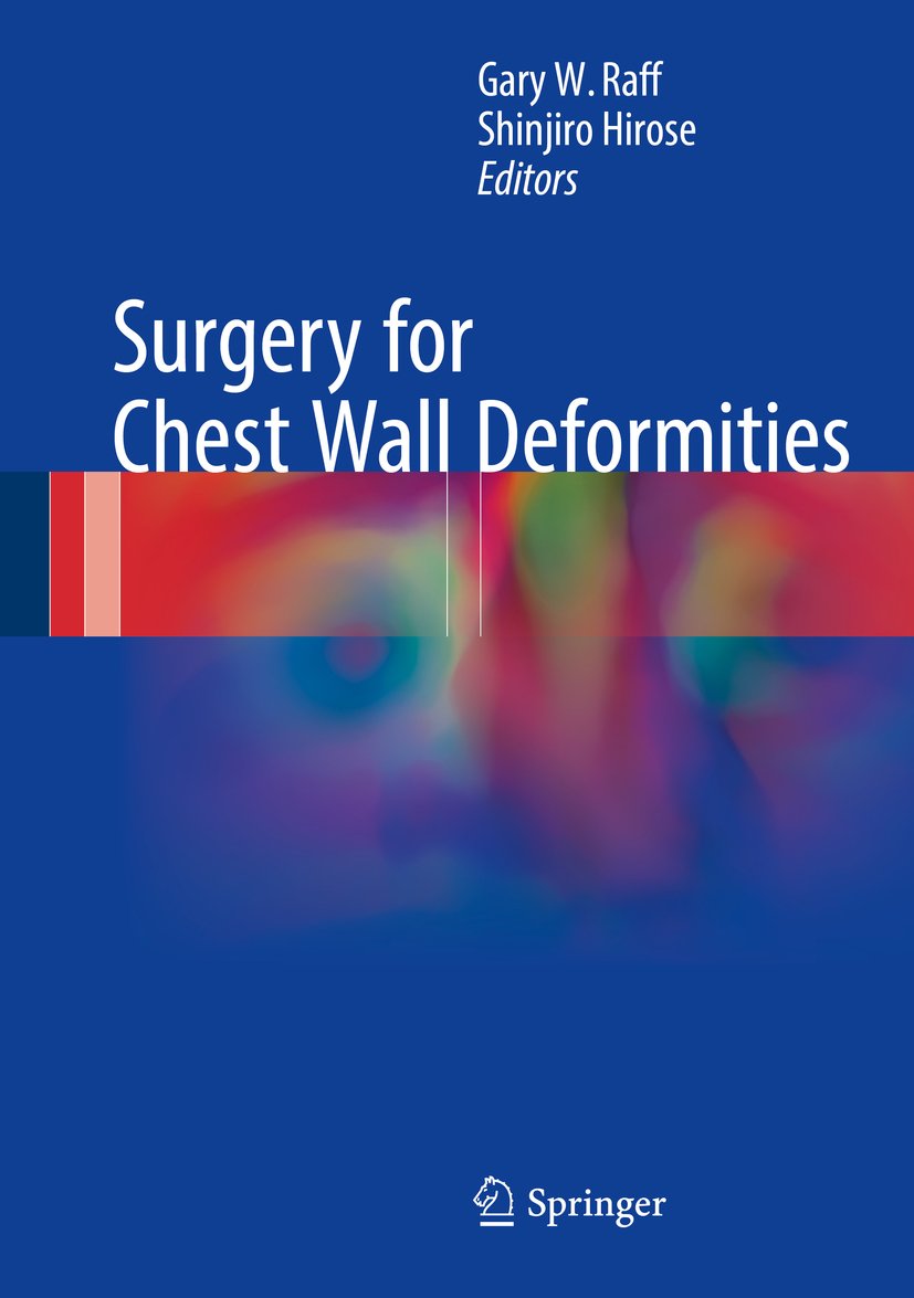 جراحی برای تغییر شکل قفسه سینه ۲۰۱۶