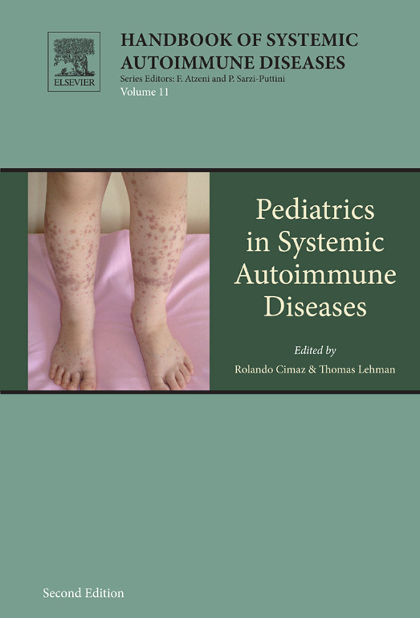 Pediatrics in Systemic Autoimmune Diseases ۲۰۰۷بیماری های خودایمنی سیستمیک در طب اطفال ۲۰۰۷