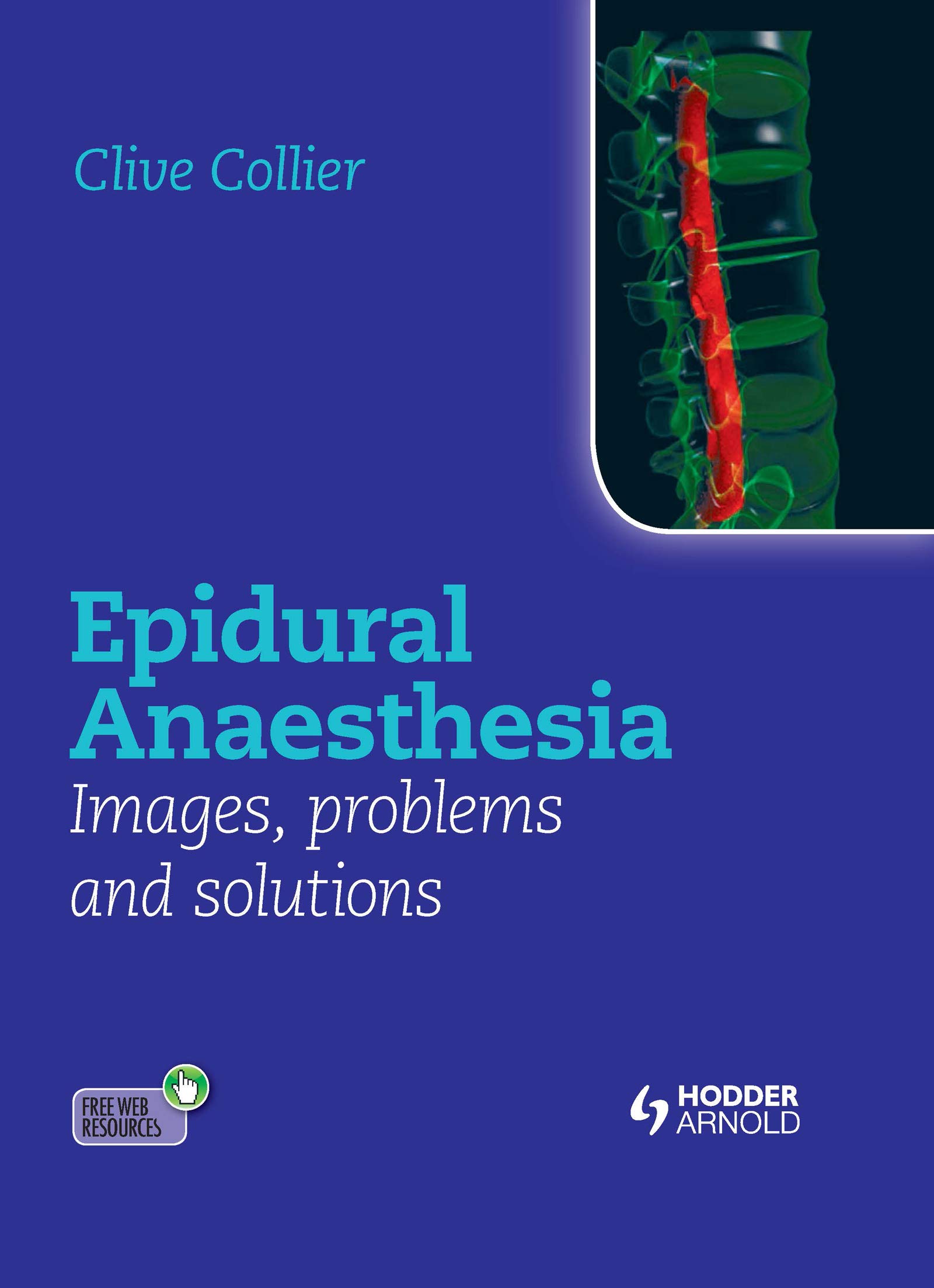 بیهوشی اپیدورال: تصاویر، مشکلات و راه حل ها ۲۰۱۲