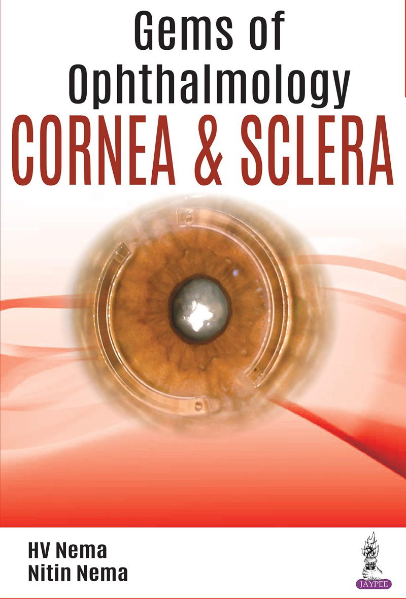 سنگهای چشم پزشکی: قرنیه و اسکلرا