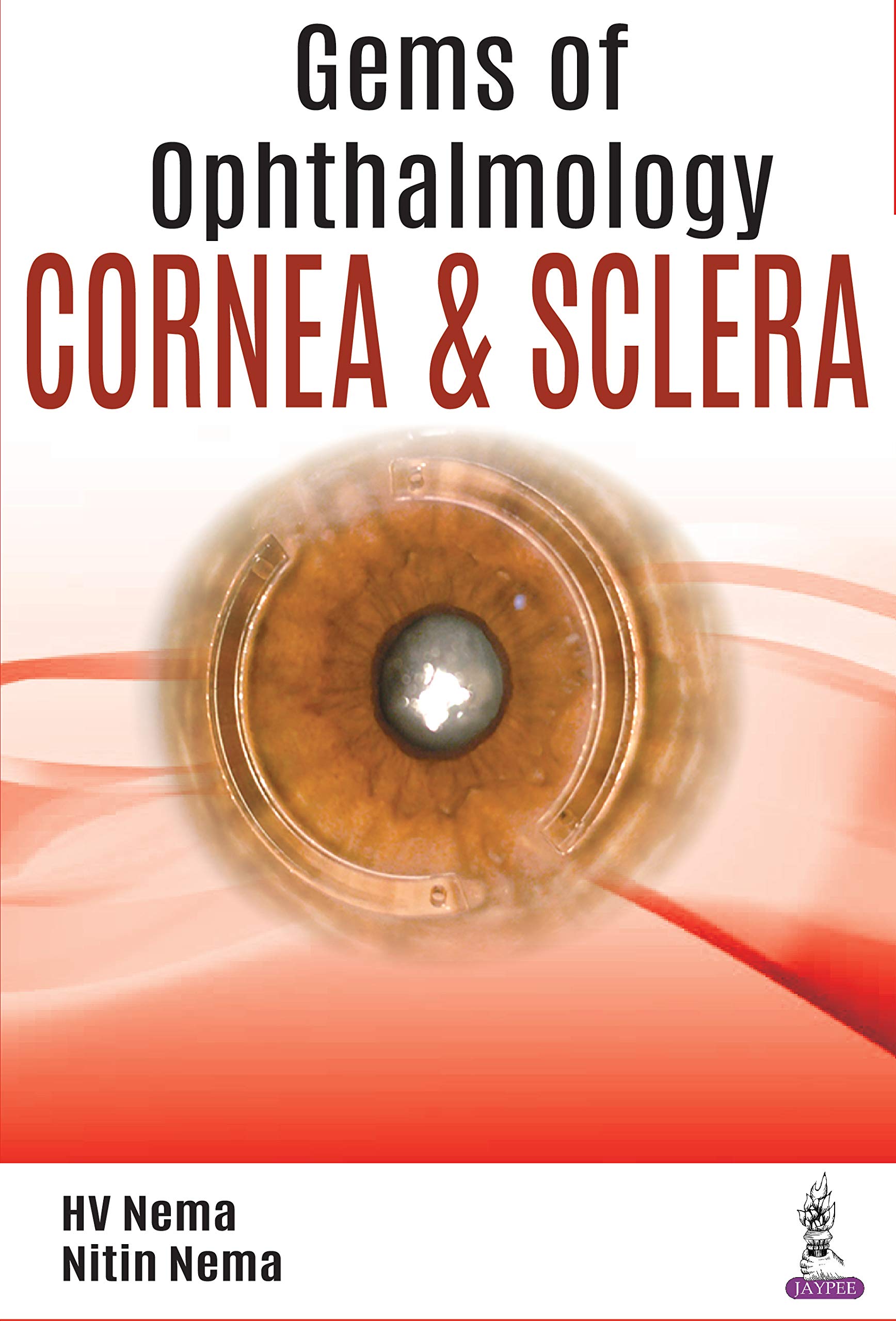 سنگهای چشم پزشکی: قرنیه و اسکلرا