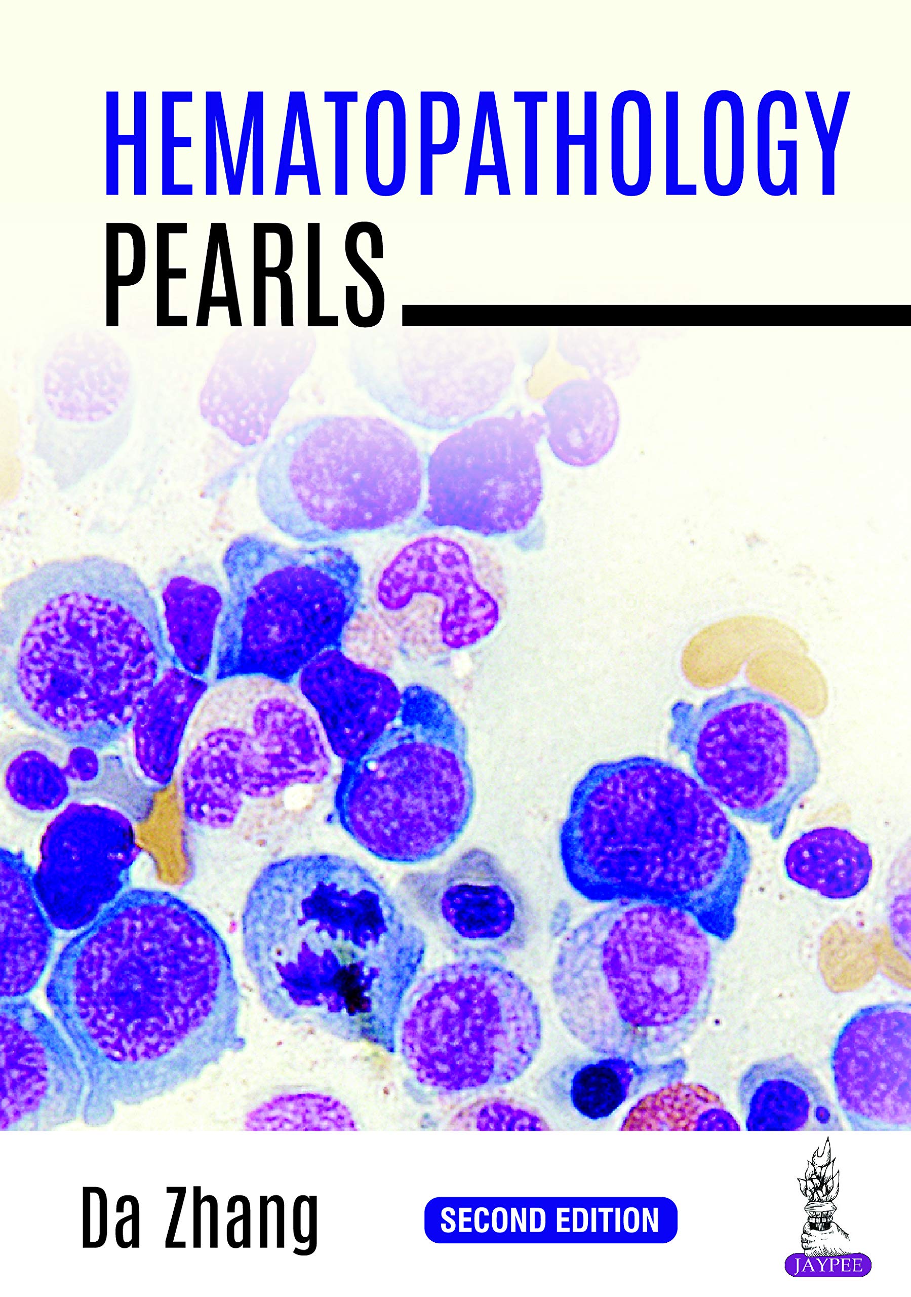 مروارید خونریزی